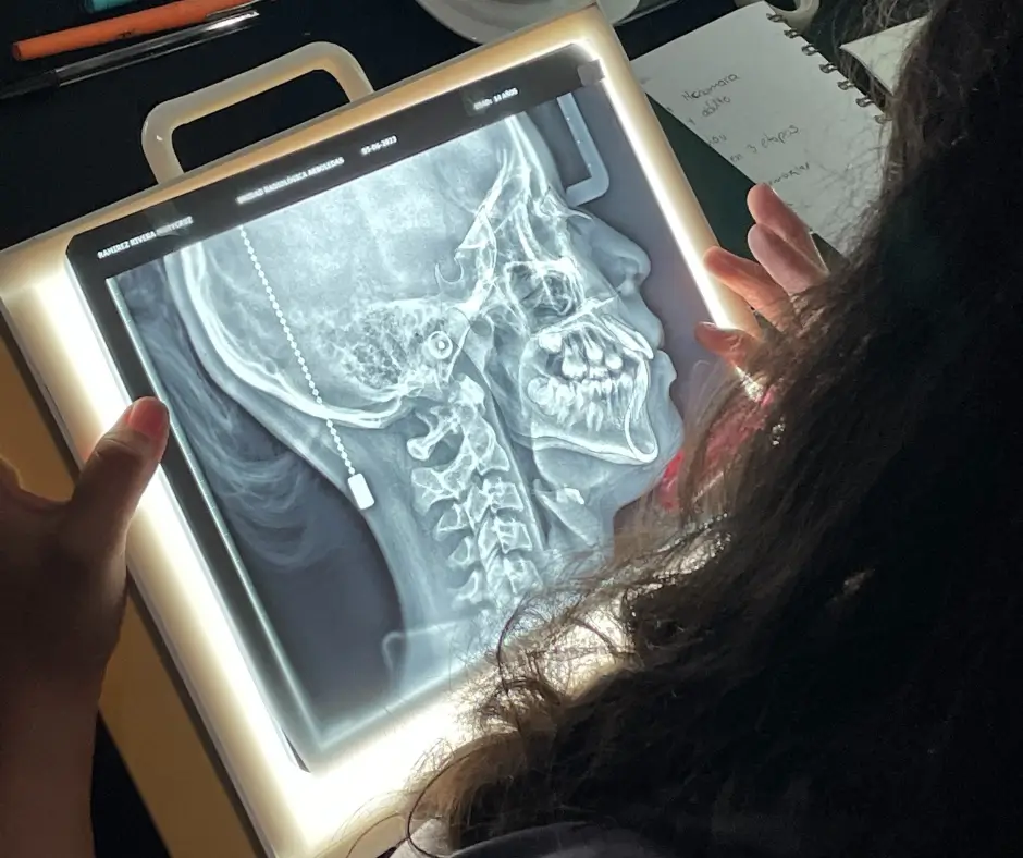 Trazado Cefalométrico