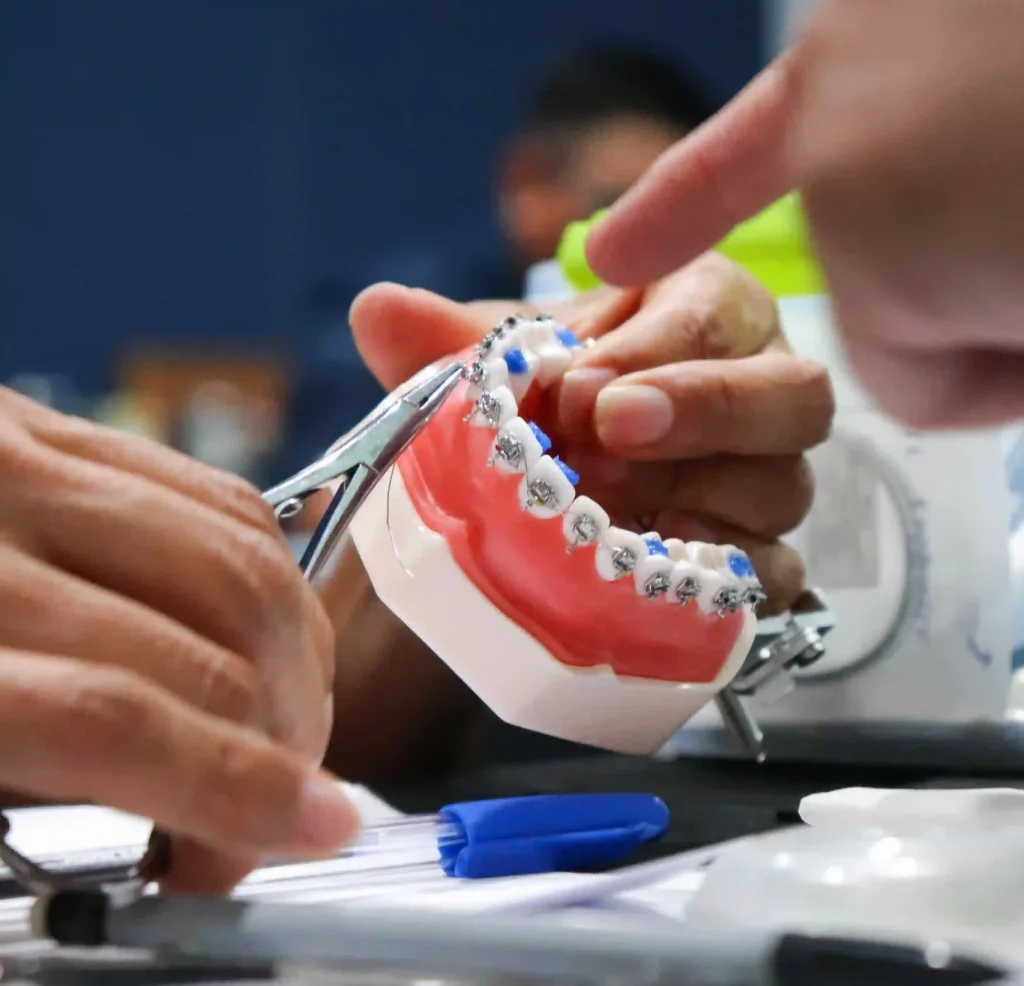 Aparatos en Ortodoncia