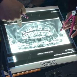 Trazado Cefalométrico