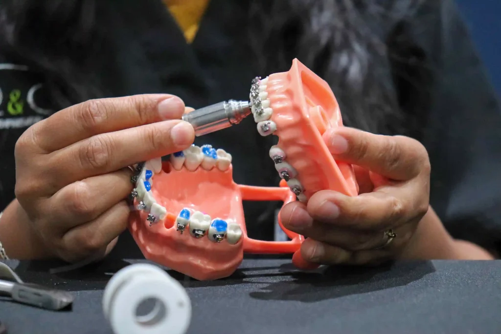 Aparatos en Ortodoncia