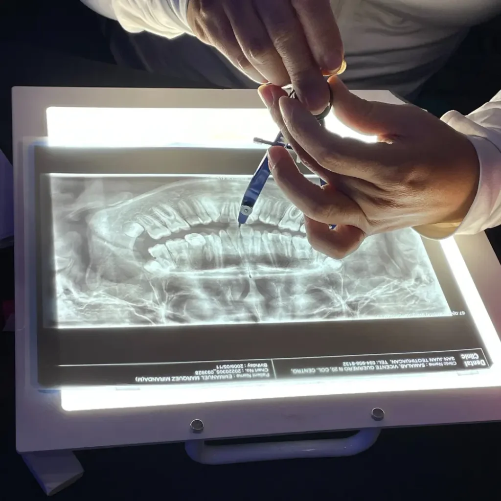 Trazado Cefalométrico