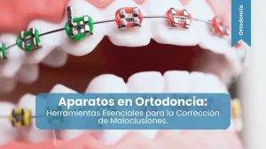 Aparatos en Ortodoncia