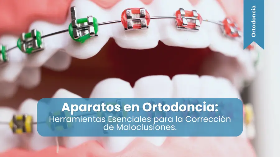Aparatos en Ortodoncia