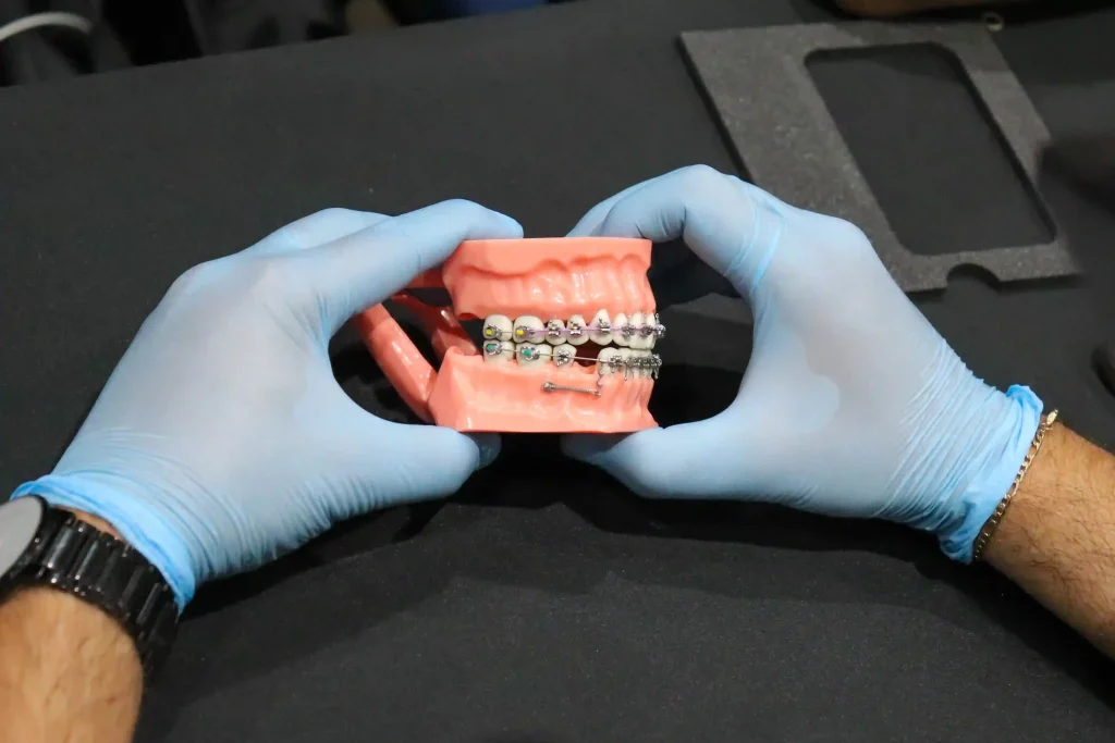 Evolución de la ortodoncia