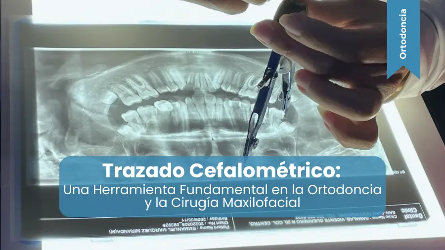 trazado cefalométrico