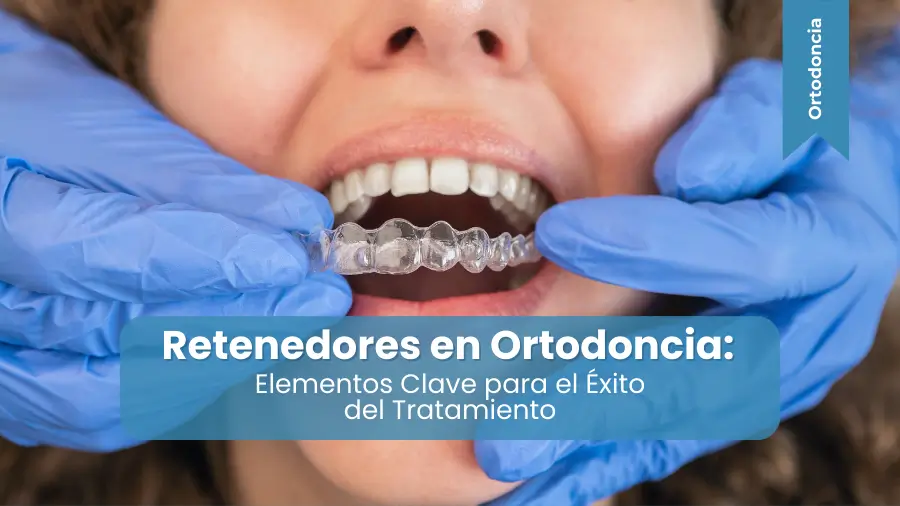 Retenedores en Ortodoncia