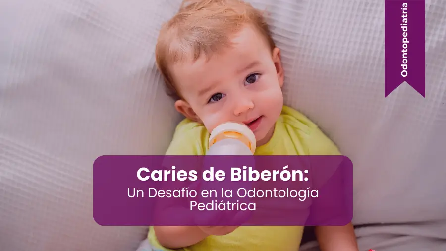 Caries De Biberon