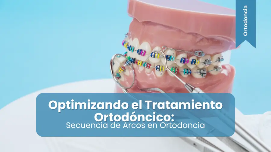 Optimizando el Tratamiento Ortodóncico Secuencia de Arcos en Ortodoncia