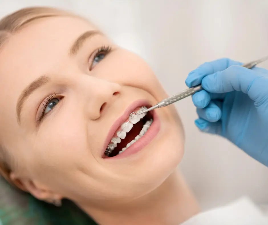 Optimizando el Tratamiento Ortodóncico Secuencia de Arcos en Ortodoncia