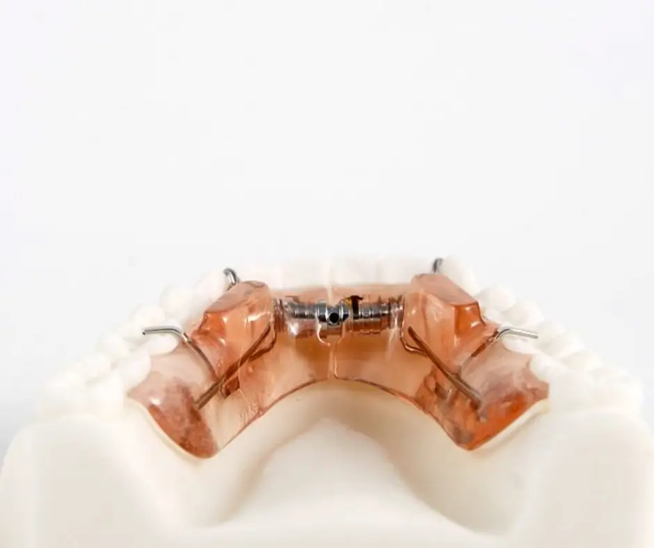 Pistas planas directas e indirectas