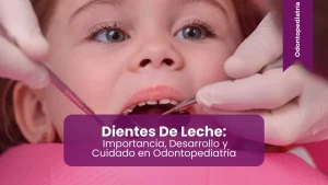Dientes de leche