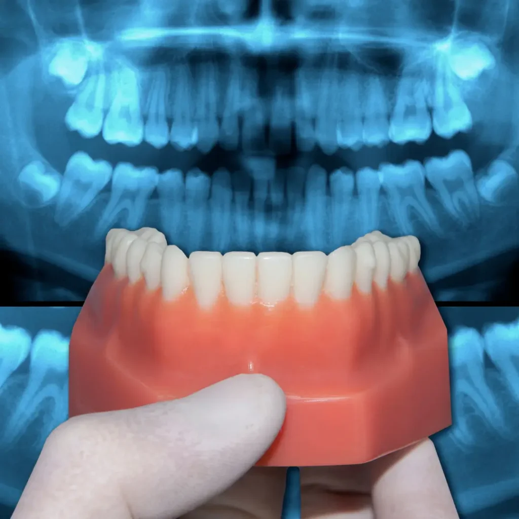 Estudios Ortodónticos Completos