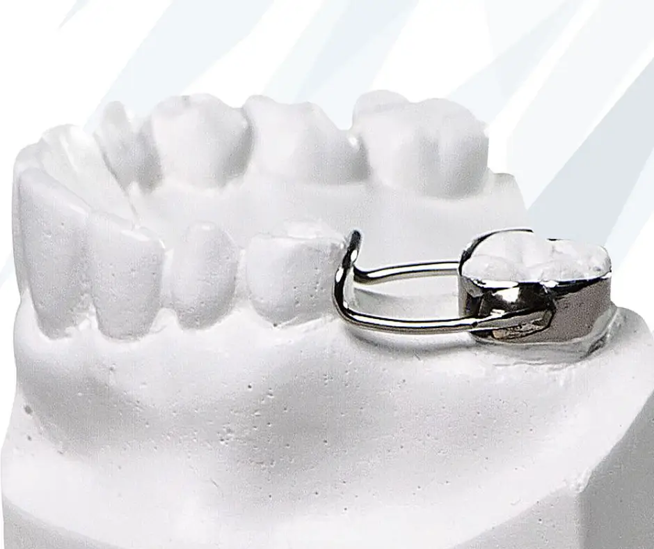 Mantenedores de espacio