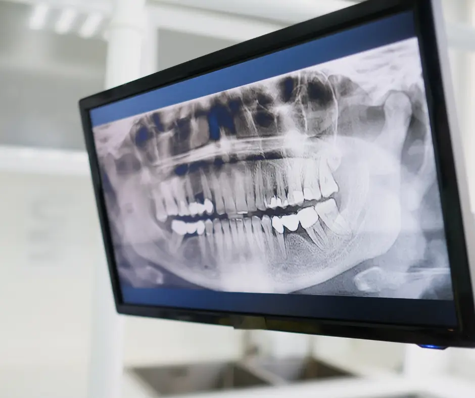 Estudios Ortodónticos Completos