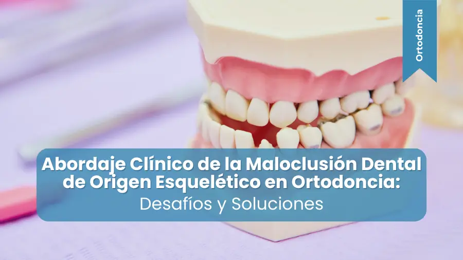maloclusión dental