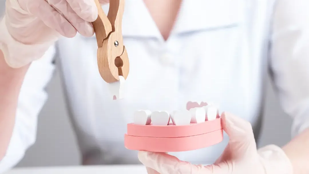 Extracciones seriadas