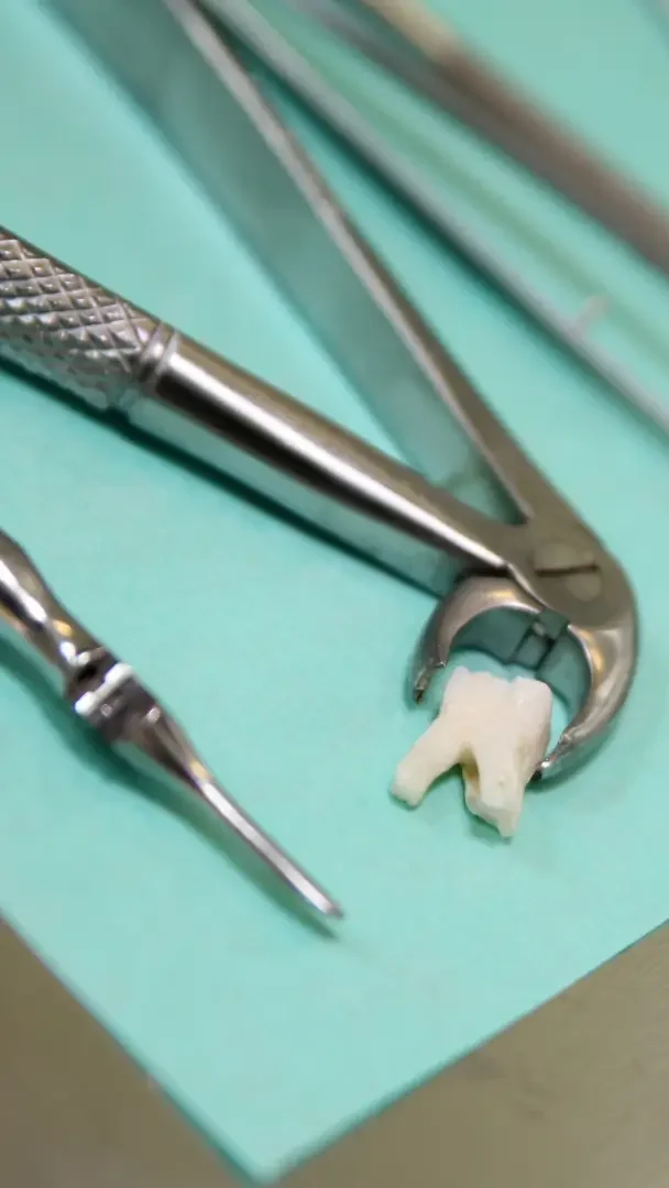 Extracciones seriadas