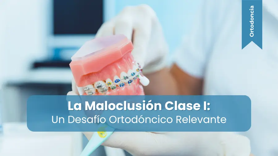 Maloclusión Clase I