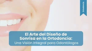 Diseño de sonrisa