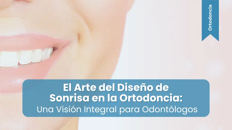 Diseño de sonrisa