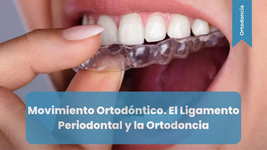 Movimiento Ortodontico