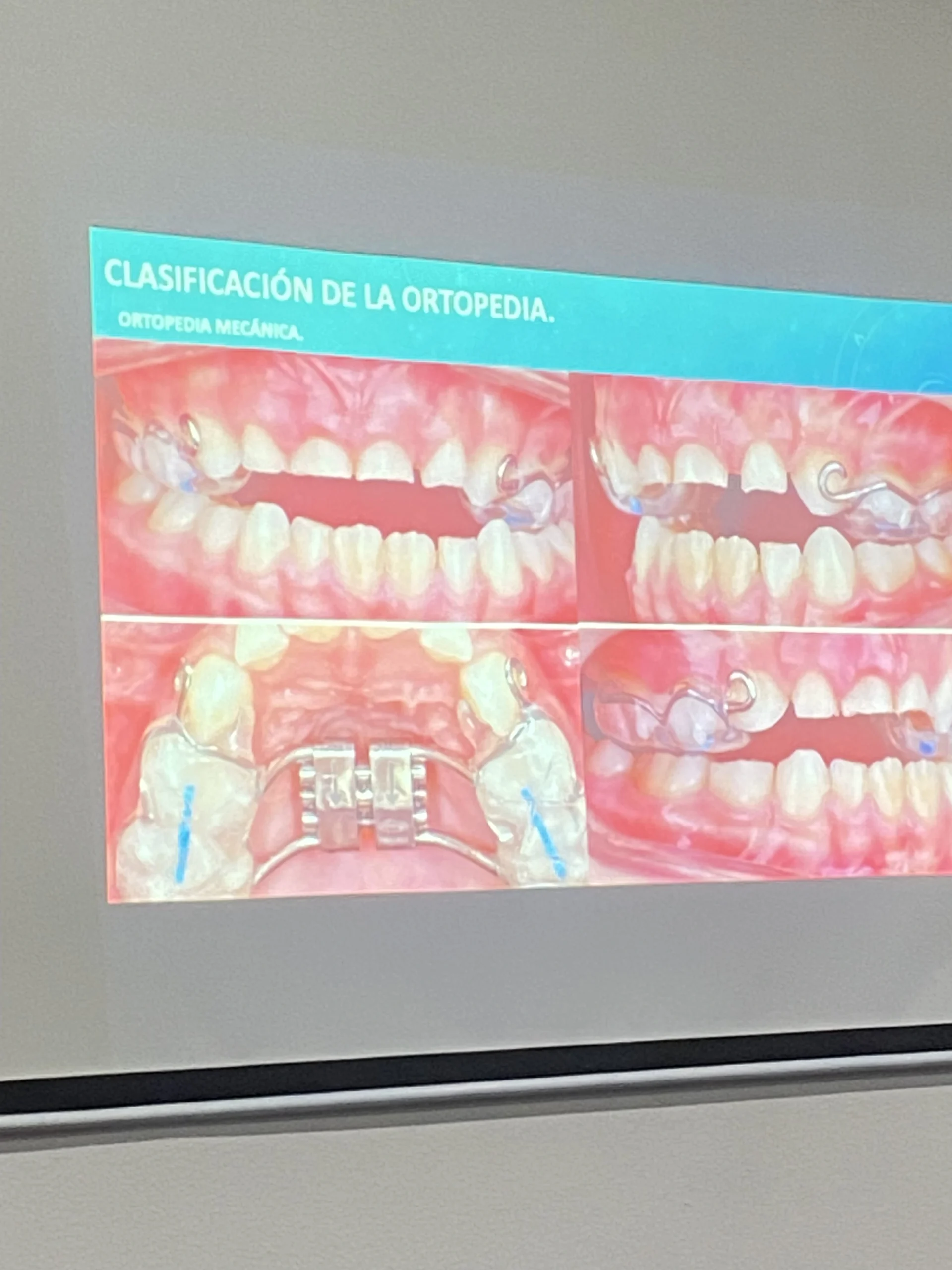 Ortopedia Cd Mex 2024