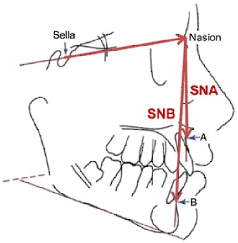 Cefalometria de Steiner imagen descriptiva