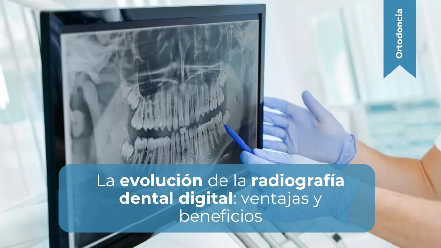 La evolución de la radiografía dental digital ventajas y beneficios