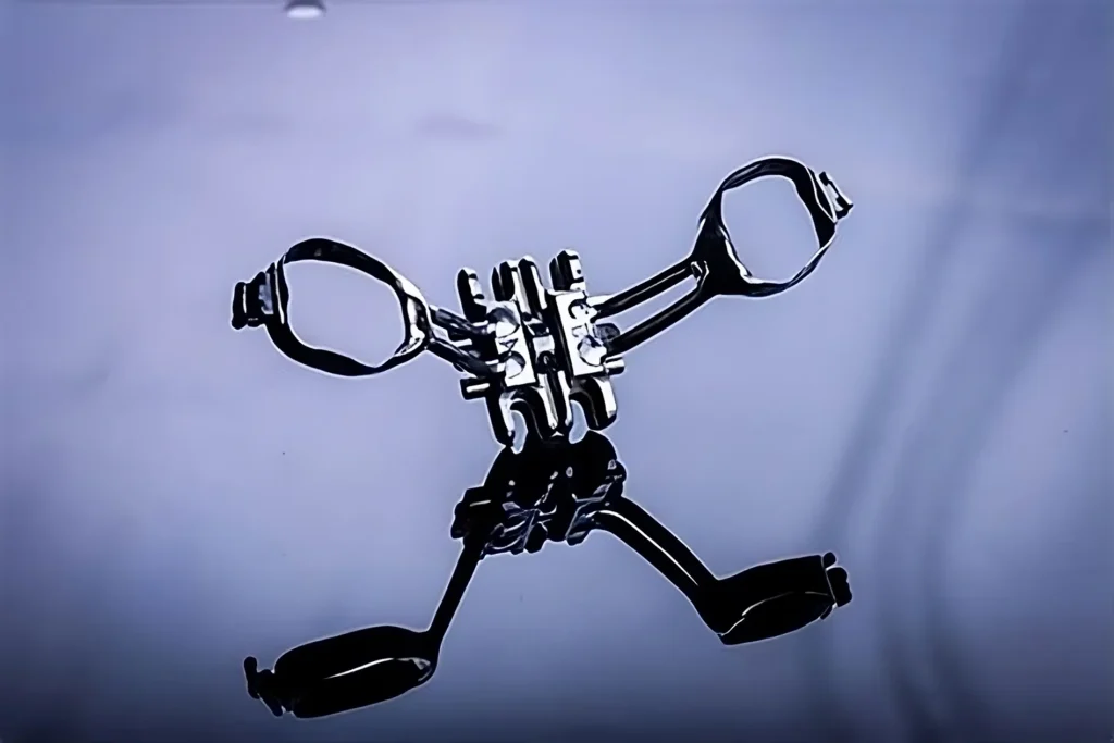 Aparato técnica de Marpe