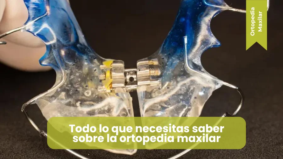 Que es la ortopedia maxilar