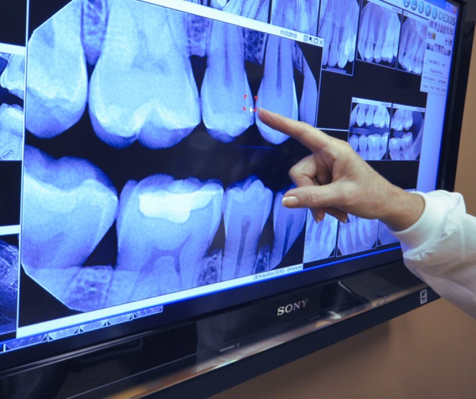 la radiografía digital