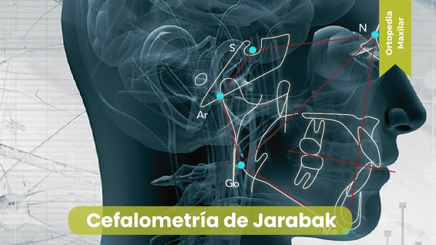 miniatura Cefalometría de Jarabak