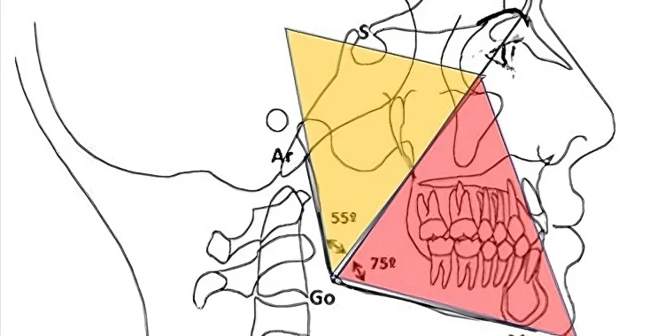 Cefalometría de Jarabak
