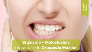 bruxismo y maloclusion