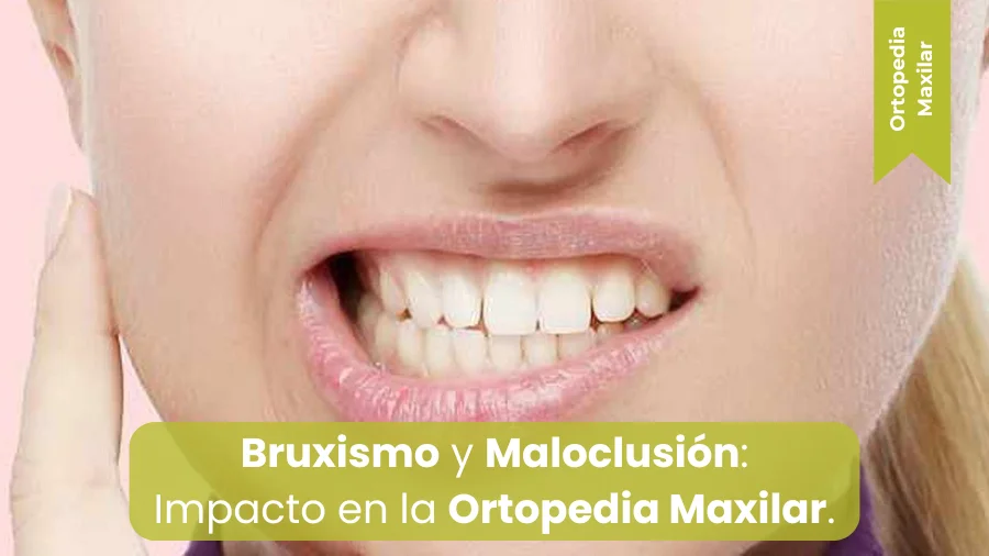 bruxismo y maloclusion
