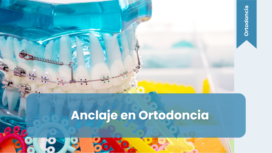 anclajes_en_ortodoncia