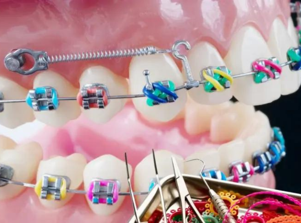 anclaje_ortodoncia